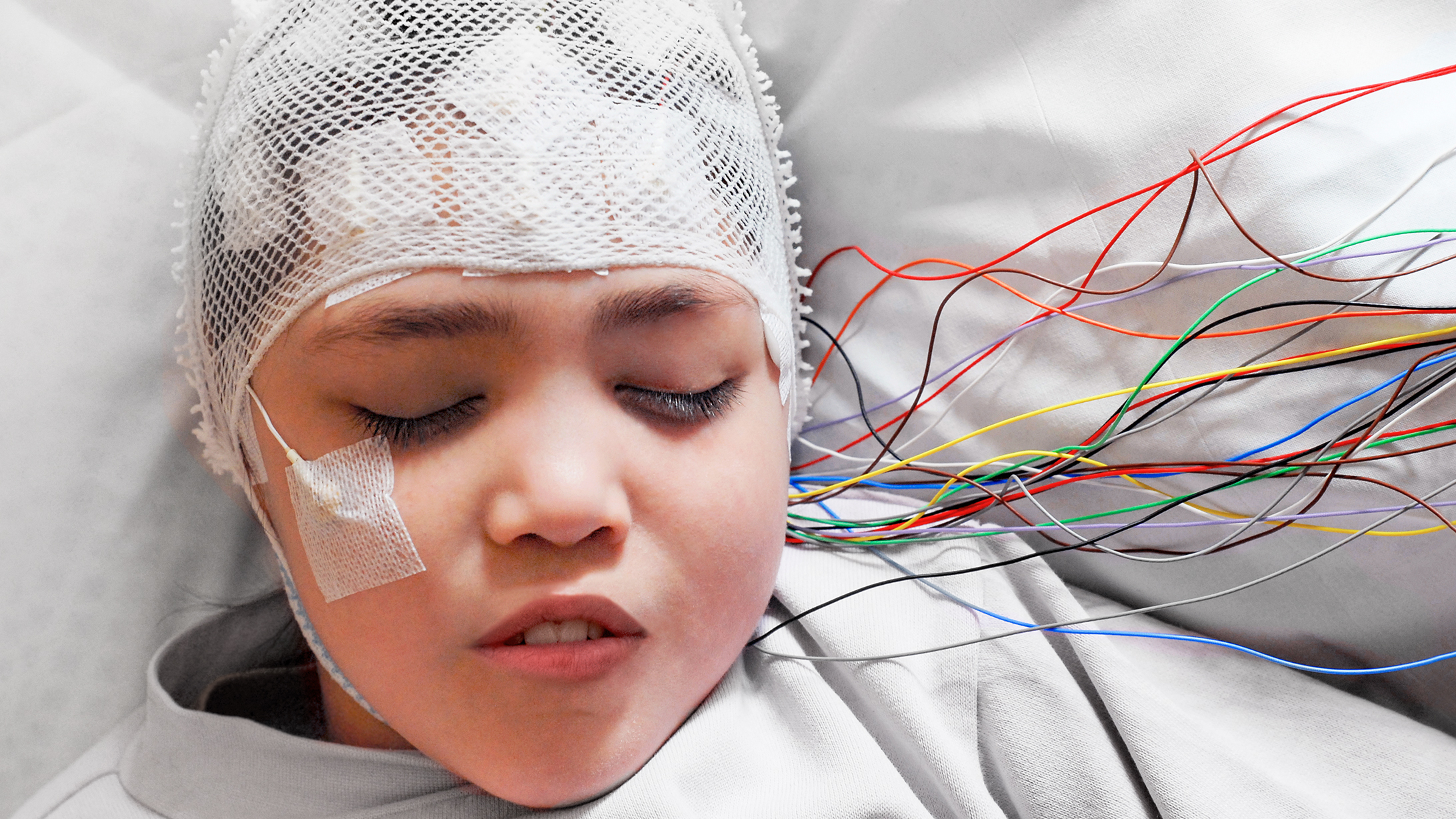 Epilepsie: ein Kind mit Elektroden am Kopf beim EEG
