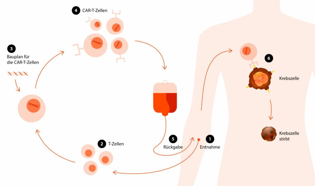 Immuntherapie: Den Krebs Austricksen – KSB-Blog