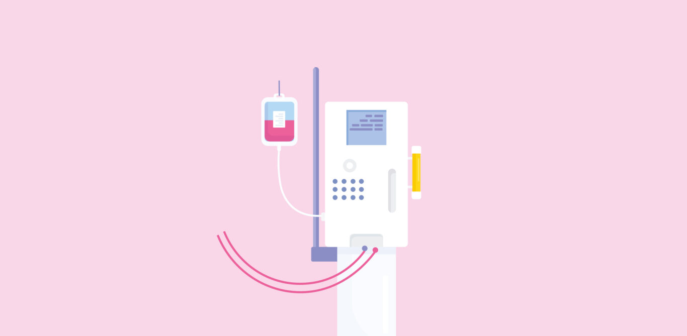 Illustration eines Dialysegeräts