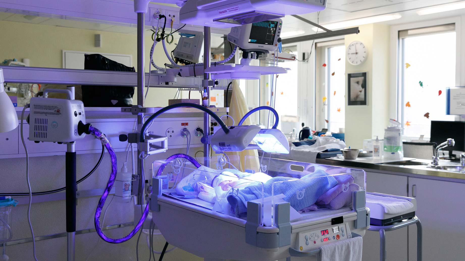Ein frühgeborenes Kind wird in der Neonatologie überwacht.