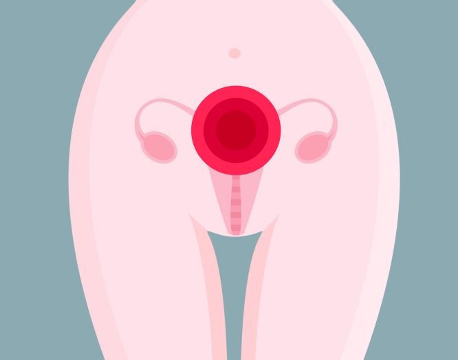 Symbolbild Endometriose