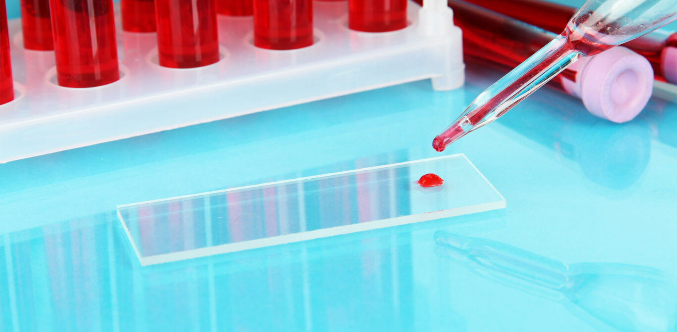 Ein Tropfen Blut auf einem Glasplättchen im Labor