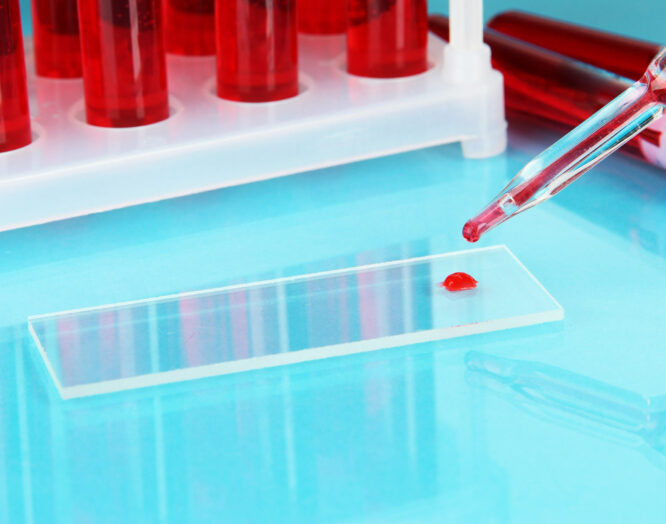Ein Tropfen Blut auf einem Glasplättchen im Labor