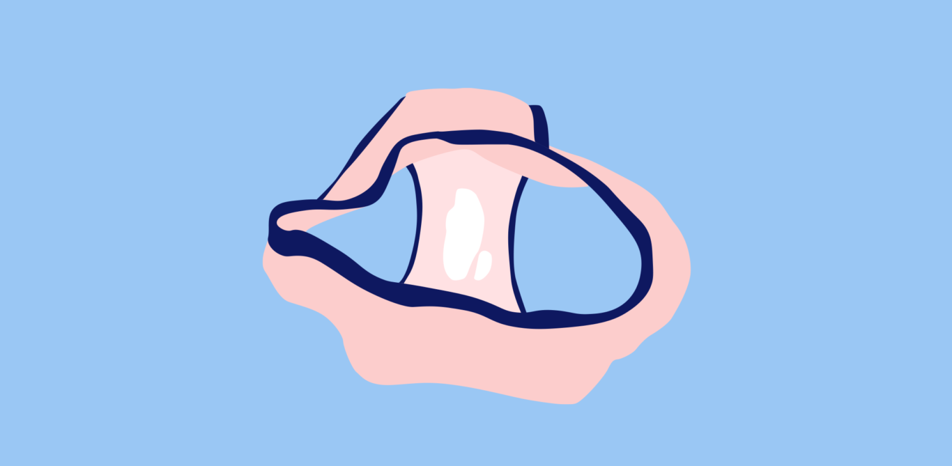 Illustration von vaginalem Ausfluss in einer Unterhose.