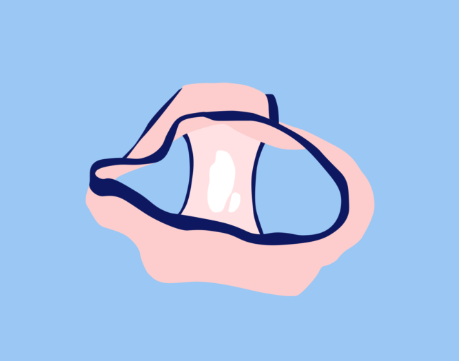 Illustration von vaginalem Ausfluss in einer Unterhose.