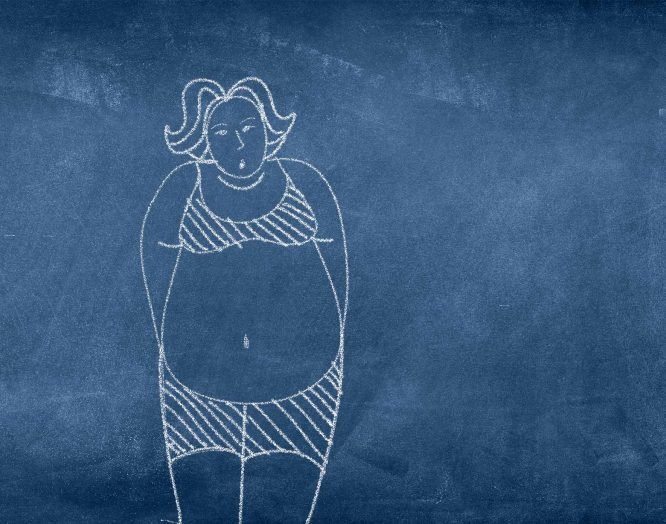 Magenbypass: Illustration Übergewicht