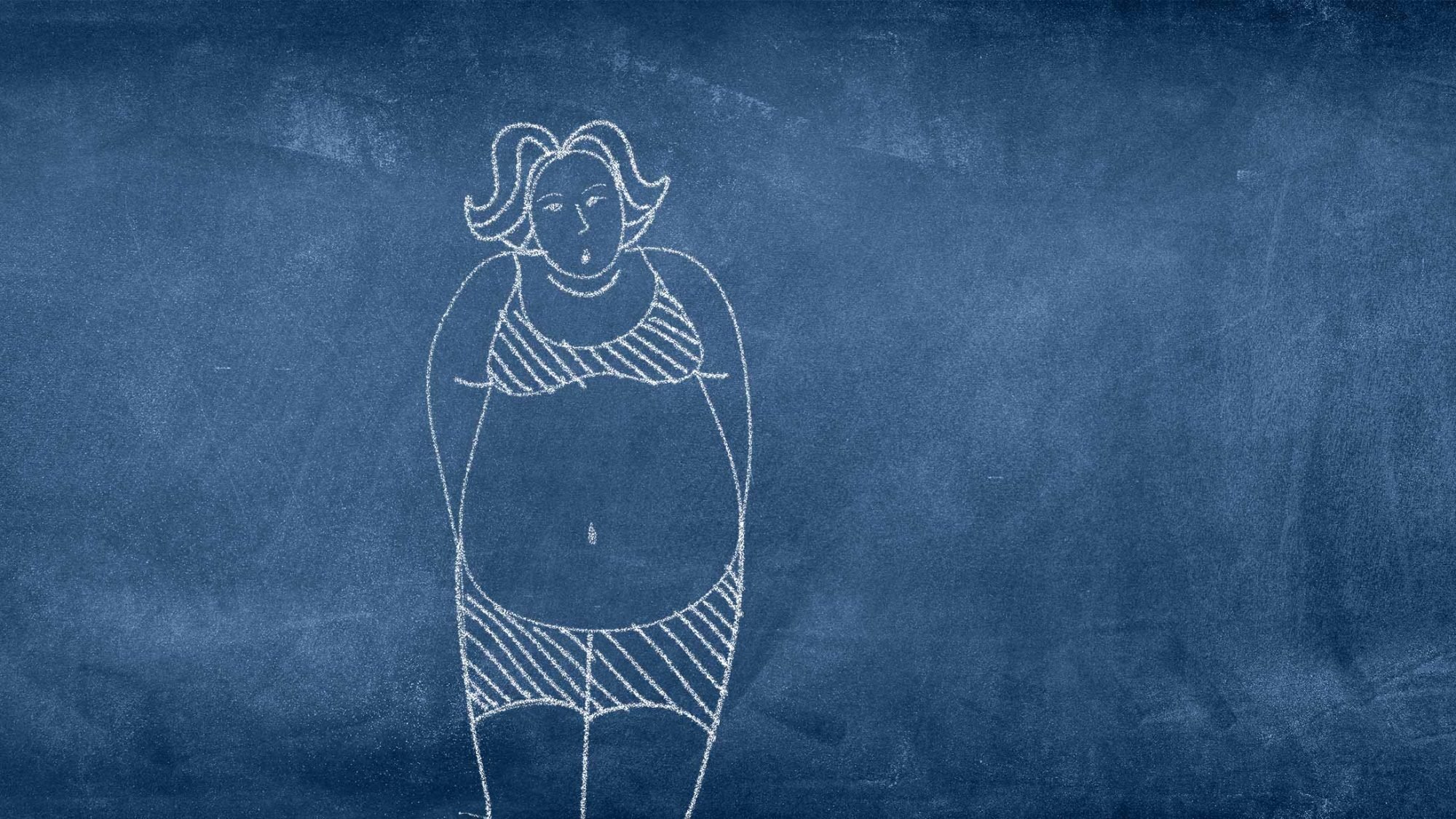Magenbypass: Illustration Übergewicht