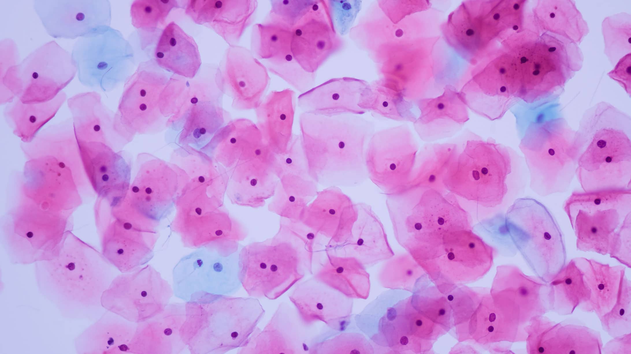 Gebärmutterzellen unter dem Mikroskop