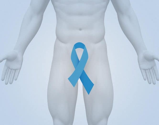 Symbolbild eines Mannes mit der blauen Krebsschleife, Symbol für Prostatakrebs
