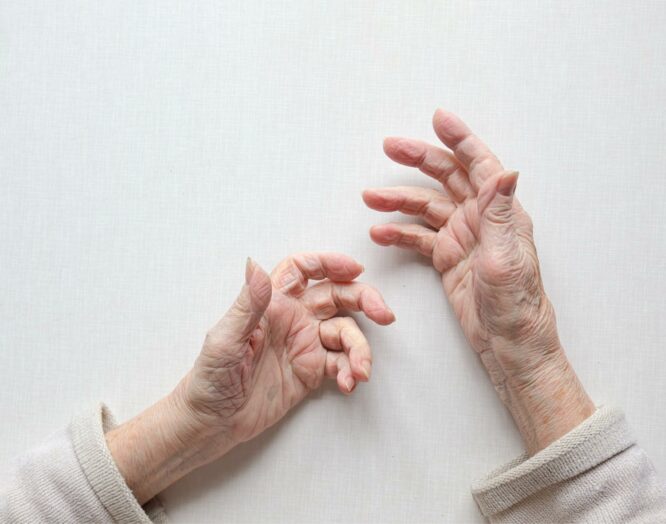 Hände einer alten Frau von oben.