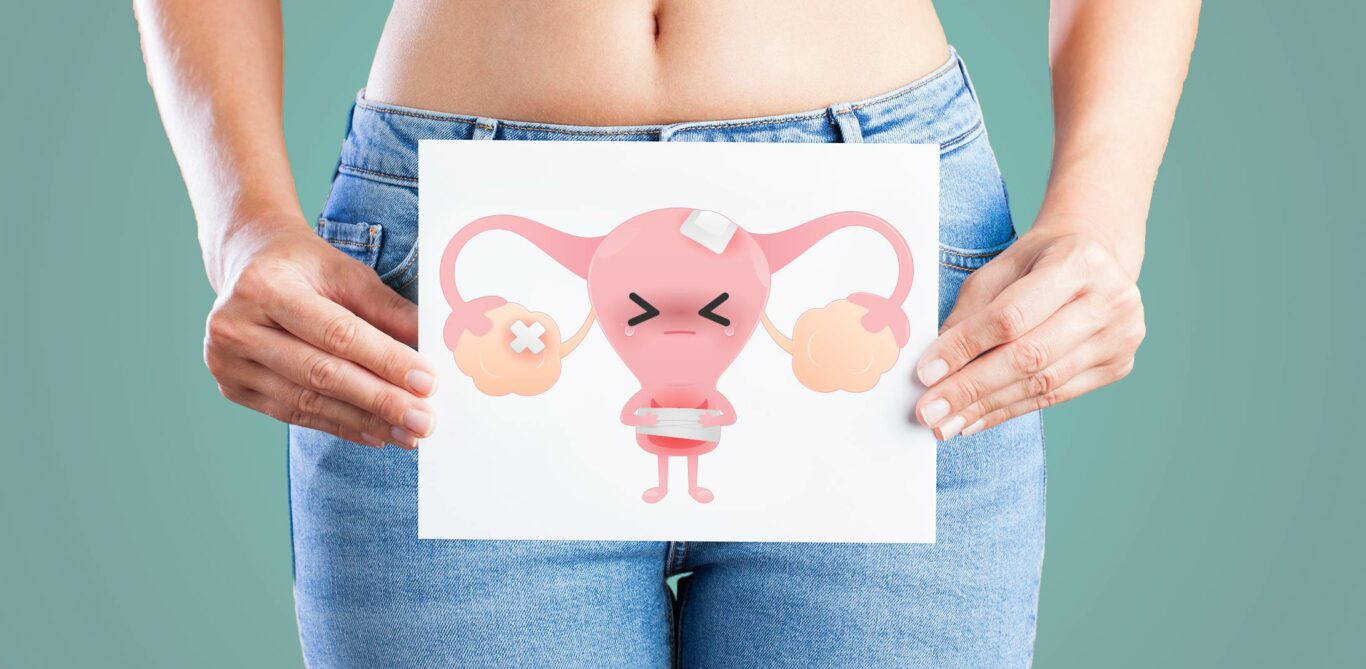 Eine Frau hält ein Blatt Papier vor ihrem Unterleib, darauf sind comicartig die Gebärmutter und die Eierstöcke abgebildet.