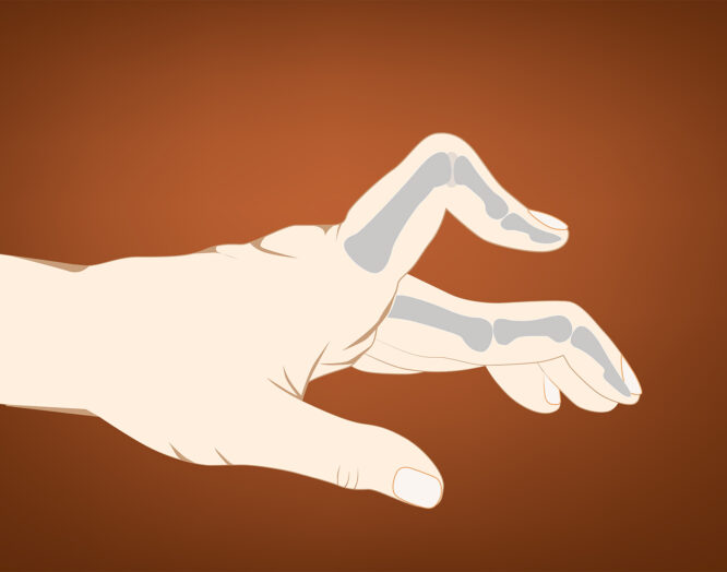 Illustration einer Hand mit Schnappfinger im Zeigefinger.