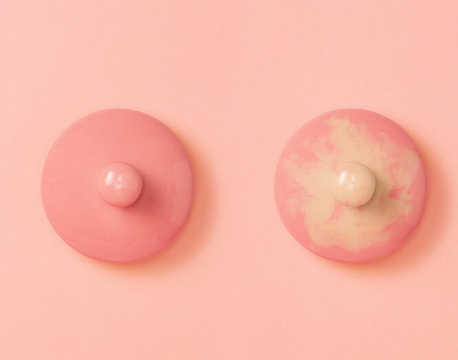 Brustkrebsrisiko: zwei Plastiknippel auf rosa Fläche